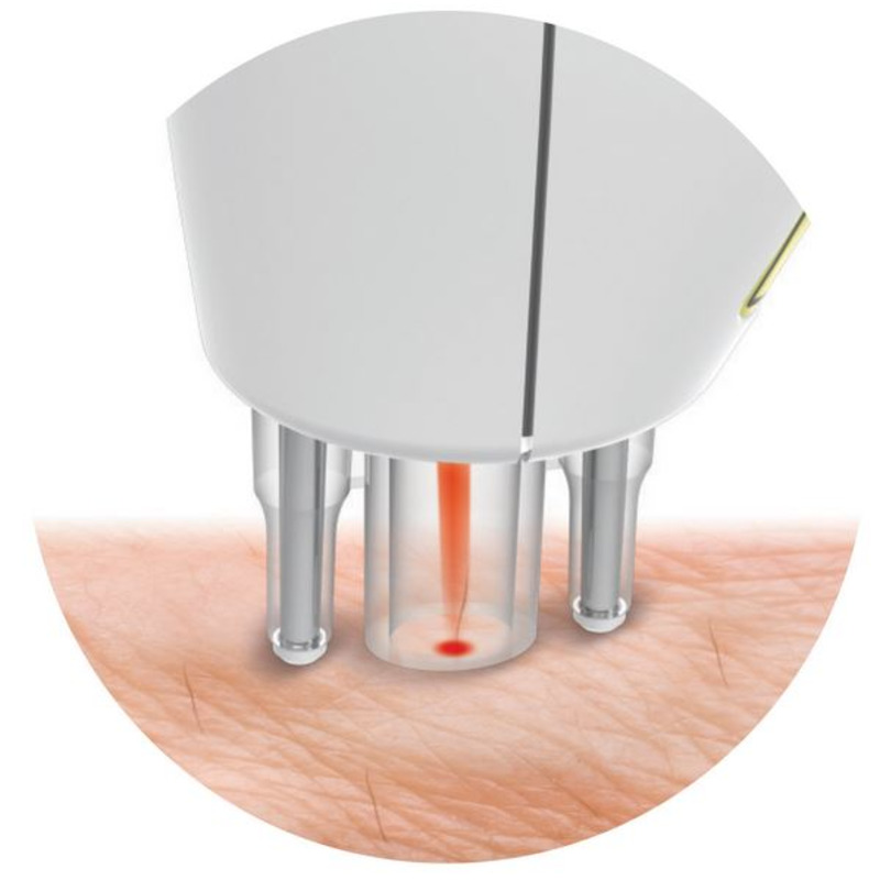 RIO HOME LASER HAIR REMOVER